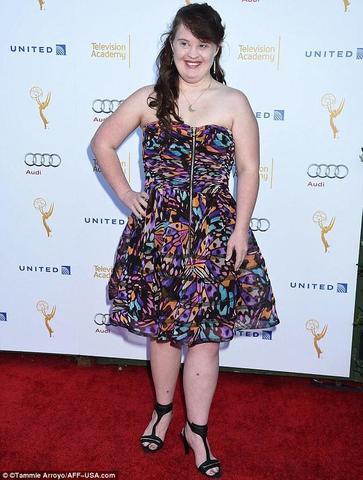actress Jamie Brewer 23 years romantic photoshoot in public